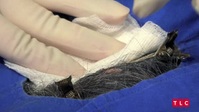 Dr Pimple Popper S07E08 XviD-AFG EZTV Dr Pimple Popper S07E08 XviD-AFG EZTV