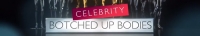 Botched Up Bodies S05E03 HDTV x264-UNDERBELLY[TGx]