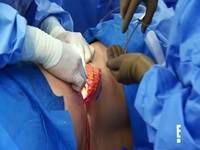 Botched S07E02 480p x264-mSD EZTV