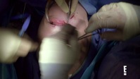 Botched S07E11 720p WEBRip x264-WEBTUBE EZTV