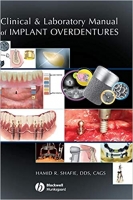 [ FreeCourseWeb ] Clinical and Laboratory Manual of Implant Overdentures