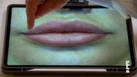Botched S08E05 XviD-AFG EZTV