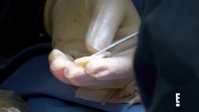 Botched S07E13 XviD-AFG EZTV Botched S07E13 XviD-AFG EZTV