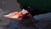 Skin A And E S04E02 XviD-AFG EZTV