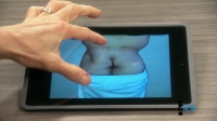 Botched S04E15 720p WEB x264-TBS[eztv]