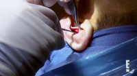 Botched S08E10 720p WEBRip x264-BAE EZTV Botched S08E10 720p WEBRip x264-BAE EZTV