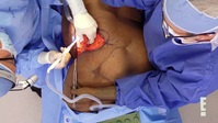 Botched S08E03 XviD-AFG EZTV