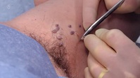 Skin A and E S03E05 XviD-AFG EZTV