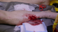 Ambulance Code Red S03E06 1080p HEVC x265-MeGusta EZTV