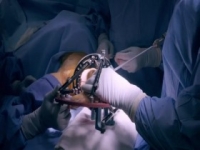 Body Bizarre S06E11 480p x264-mSD [eztv]