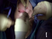 Botched S07E11 480p x264-mSD EZTV Botched S07E11 480p x264-mSD EZTV