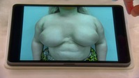 Botched S07E16 XviD-AFG EZTV