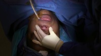 Botched S07E12 1080p WEB h264-WEBTUBE EZTV