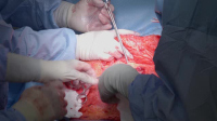 Botched Bariatrics S01E02 XviD-AFG EZTV