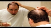 [ FreeCourseWeb ] Natural Remedies To Treat Hair Loss. You Should Try