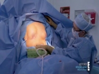 Botched S05E10 Playing With Fire 480p x264-mSD [eztv]
