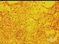 Forensic Files S04E12 DSR x264-REGRET [eztv]