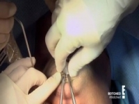 Botched S06E12 Jaw Dropping Booberati 480p x264-mSD [eztv]