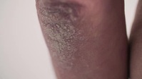 Save My Skin S04E09 Groin Pains XviD-AFG EZTV
