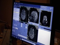 Our Brain S01E02 480p x264-mSD EZTV
