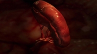 Monsters Inside Me S06E09 WEB h264-CROSSFIT[eztv]