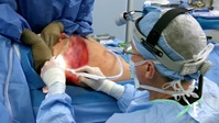 Botched S07E07 720p HEVC x265-MeGusta EZTV