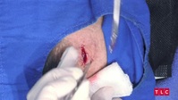 Dr Pimple Popper S07E06 XviD-AFG EZTV Dr Pimple Popper S07E06 XviD-AFG EZTV