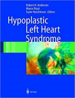 [ FreeCourseWeb ] Hypoplastic Left Heart Syndrome