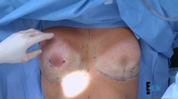 Botched S04E03 720p WEB x264-TBS[eztv]