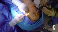 Botched S08E10 XviD-AFG EZTV